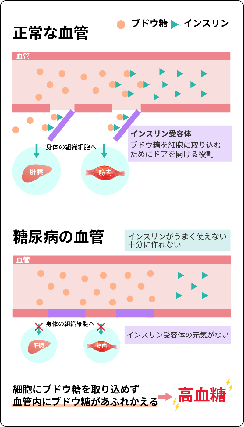 正常な血管　糖尿病の血管